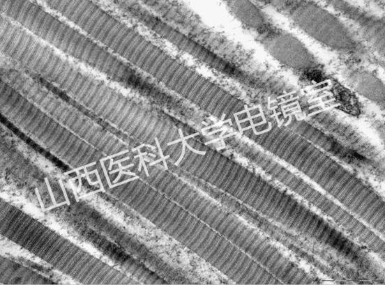 胶原纤维