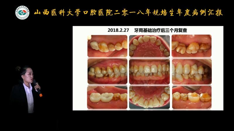 一等奖选手张丽娜在病例汇报