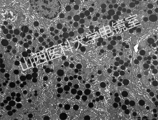 胰腺内分泌细胞