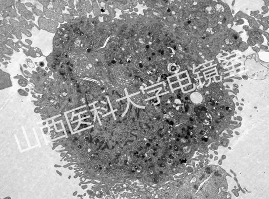 破骨细胞